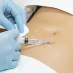 Slimming-mesotherapy-center